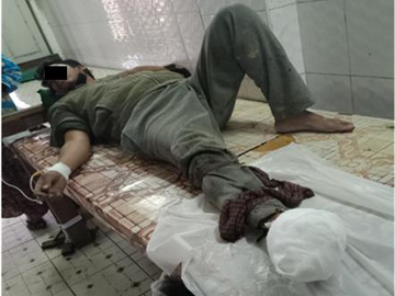 A Man was injured by stepping on a Landmine, which exploded, in Tanaing Township