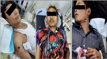 ရွှေဘိုမြို့နယ်၌ လက်လုပ်မိုင်းပေါက်ကွဲ၍ အမျိုးသား ၃ ဦးဒဏ်ရာရရှိမှု