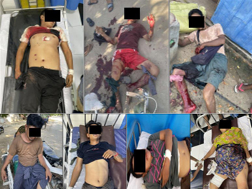 Five males and a female were injured while a male was dead by a grenade explosion in Monywa Township.