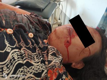 A woman shot dead in Zay Cho Myauk Ward, Gyobingauk Township of Bago Region.