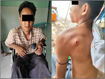 Two innocent civilians were injured in explosion device planted by a terrorist faction in Myingyan Township of Mandalay Region.