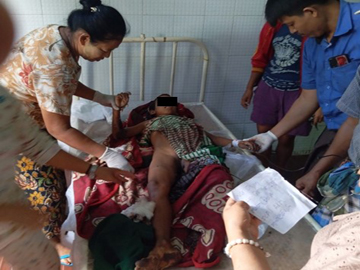 စစ်ကိုင်းတိုင်းဒေသကြီး၊ ကသာမြို့နယ်၌ KIA လက်နက်ကိုင်သောင်းကျန်းသူအဖွဲ့နှင့် PDF အမည်ခံ အကြမ်းဖက်သမားများ ပူးပေါင်းအဖွဲ့ထောင်ထားသည့် မိုင်း တစ်လုံး ပေါက်ကွဲခဲ့မှုကြောင့် အပြစ်မဲ့ ကလေးငယ် တစ်ဦး ထိခိုက်ဒဏ်ရာရရှိမှု မှတ်တမ်းဓာတ်ပုံ။