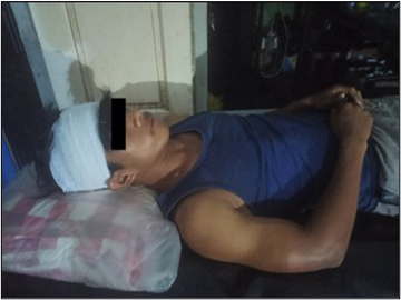 An innocent civilian was injured in a heavy weapon attack by KIA insurgents and so-called PDF terrorists in Kathar Township of Sagaing Region.