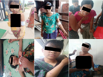 Innocent civilians, including children, were killed and injured in a heavy weapon attack by a so-called PDF terrorist group in Madaya Township, Mandalay Region.
