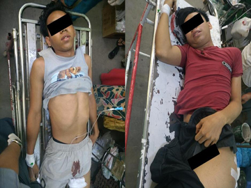 Two innocent civilians were injured in an attack by a so-called PDF terrorist group in Sagaing Township of Sagaing Region.