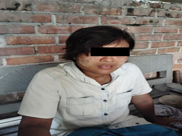 An innocent civilian was injured in a heavy weapon attack by a so-called PDF terrorist group in Madaya Township of Mandalay Region. 