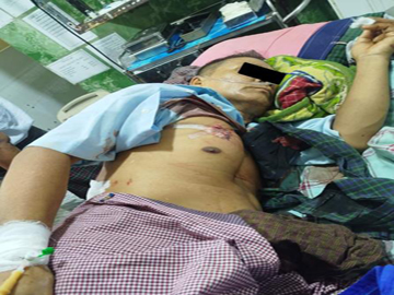 A 100-household elder was injured in an attack by so-called PDF terrorists in Pyin Chaug Village, Taungdwingyi Township of Magway Region.