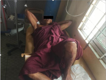 A monk injured after stepping on an explosive device planted by a so-called PDF terrorist group in Salin Township of Magway Region.