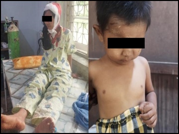 Mother and baby were injured in a heavy weapon attack by a so-called PDF terrorist group in Minhla Township, Bago Region.