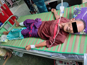 An innocent civilian injured in an attack by a combined group of pro-terrorism KNU members and so-called PDF terrorists in Kawkareik Township of Kayin State.