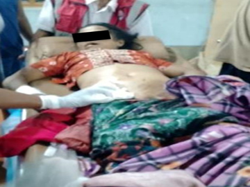 An innocent civilian killed in a heavy weapon attack by a so-called PDF terrorist group in Madaya Township of Mandalay Region.