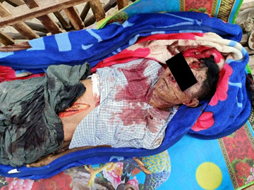 မန္တလေးတိုင်းဒေသကြီး၊ မိတ္ထီလာမြို့နယ်၌ PDF အမည်ခံ အကြမ်းဖက်သမားများက သေနတ်/ဓားများဖြင့် ပစ်ခတ်ထိုးခုတ်ခဲ့မှုကြောင့် ကျေးရွာအုပ်ချုပ်ရေးမှူး တစ်ဦး သေဆုံးမှု မှတ်တမ်းဓာတ်ပုံ။