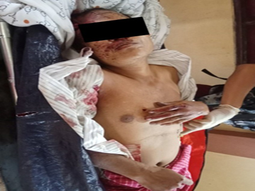 မွန်ပြည်နယ်၊ ရေးမြို့နယ်၌ KNU အကြမ်းဖက်အဖွဲ့နှင့် PDF အမည်ခံ အကြမ်းဖက်သမားများ ပူးပေါင်းအဖွဲ့က သေနတ်ဖြင့် ပစ်ခတ်သတ်ဖြတ်ခဲ့မှုကြောင့် အပြစ်မဲ့ အရပ်သားပြည်သူ တစ်ဦး သေဆုံးမှု မှတ်တမ်းဓာတ်ပုံ။