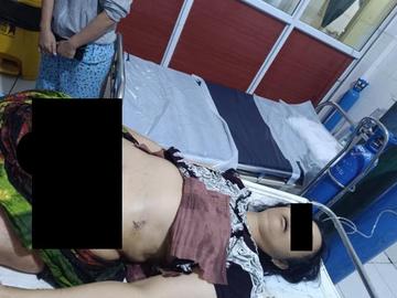 စစ်ကိုင်းတိုင်းဒေသကြီး၊ စစ်ကိုင်းမြို့နယ်၌ PDF အမည်ခံ အကြမ်းဖက်သမားများက သေနတ်ဖြင့်  ပစ်ခတ်သတ်ဖြတ်ခဲ့မှုကြောင့် အမျိုးသမီး တစ်ဦး သေဆုံးမှု မှတ်တမ်းဓာတ်ပုံ။