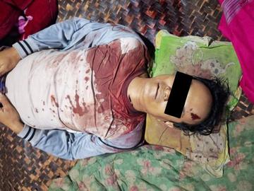 ရှမ်းပြည်နယ်၊ ရွာငံမြို့နယ်၌ PDF အမည်ခံ အကြမ်းဖက်သမားများက သံတုတ်၊ ဓားများဖြင့် ရိုက်နှက်ထိုးခုတ်သတ်ဖြတ်သွားခဲ့သဖြင့် အပြစ်မဲ့ အရပ်သားပြည်သူ တစ်ဦး သေဆုံးမှု မှတ်တမ်းဓာတ်ပုံ။