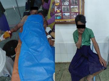 Two innocent civilians injured after triggering a landmine planted by a   so-called PDF terrorists in Loikaw Township of Kayah State.