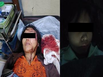 မကွေးတိုင်းဒေသကြီး၊ ရေစကြိုမြို့နယ်၌ PDF အမည်ခံ အကြမ်းဖက်သမားများက သေနတ်ဖြင့် ပစ်ခတ်ခဲ့မှုကြောင့် အပြစ်မဲ့ အရပ်သားပြည်သူ နှစ်ဦး ထိခိုက်ဒဏ်ရာရရှိမှု မှတ်တမ်းဓာတ်ပုံ။