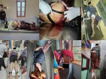 မကွေးတိုင်းဒေသကြီး၊ ပခုက္ကူမြို့နယ်၌ PDF အမည်ခံ အကြမ်းဖက်သမားများက Drone ဖြင့်  Drop Bomb များ ပစ်ချတိုက်ခိုက်ခဲ့မှုကြောင့် အမျိုးသား တစ်ဦးနှင့် အမျိုးသမီး တစ်ဦး  သေဆုံးကာ ပြည်သူ့စစ်အဖွဲ့ဝင် တစ်ဦး၊ အမျိုးသား တစ်ဦးနှင့် အမျိုးသမီး  သုံးဦးတို့ ထိခိုက်ဒဏ်ရာရရှိမှု မှတ်တမ်းဓာတ်ပုံ။