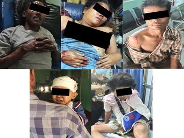 မကွေးတိုင်းဒေသကြီး၊ ရေစကြိုမြို့နယ်၌ PDF အမည်ခံ အကြမ်းဖက်သမားများက Drone ဖြင့်  Drop Bomb များ ပစ်ချတိုက်ခိုက်ခဲ့မှုကြောင့် ကလေးငယ် နှစ်ဦး အပါအဝင် အမျိုးသား  နှစ်ဦးနှင့် အမျိုးသမီး တစ်ဦးတို့ ထိခိုက်ဒဏ်ရာရရှိမှု မှတ်တမ်းဓာတ်ပုံ။