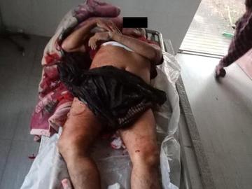 ပဲခူးတိုင်းဒေသကြီး၊ ညောင်လေးပင်မြို့နယ်၌ KNU အကြမ်းဖက်အဖွဲ့နှင့် PDF အမည်ခံ  အကြမ်းဖက်သမားများ ပူးပေါင်းအဖွဲ့က သေနတ်ဖြင့် ပစ်ခတ်သတ်ဖြတ်ခဲ့မှုကြောင့် ရပ်ကွက်အုပ်ချုပ်ရေးမှူး တစ်ဦး သေဆုံးမှု မှတ်တမ်းဓာတ်ပုံ။