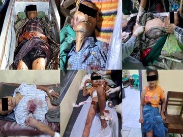 Two innocent civilians killed, four others injured in a drone attack by so-called PDF terrorists in Yesagyo Township of Magway Region.