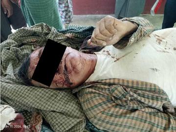 Innocent Civilian Shot Dead by So-Called PDF Terrorists   in Taungtwingyi Township of Magway Region.