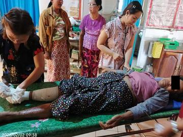 An innocent civilian injured in an improvised explosive device explosion planted by so-called PDF terrorists in Palaw Township of Tanintharyi Region.