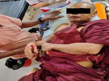 A monk injured in a heavy weapon attack by so-called PDF terrorists in  Dawei Township of Tanintharyi Region.