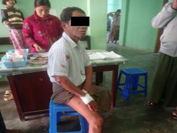 စစ်ကိုင်းတိုင်းဒေသကြီး၊ ကျွန်းလှမြို့နယ်၌ လက်နက်ကိုင်အကြမ်းဖက်အဖွဲ့များက စိန်ပြောင်းများဖြင့် ပစ်ခတ်တိုက်ခိုက်ခဲ့မှုကြောင့် နိုင်ငံရေးပါတီဝင် တစ်ဦး ထိခိုက်ဒဏ်ရာရရှိမှု မှတ်တမ်းဓာတ်ပုံ။