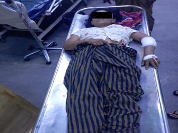 In innocent civilian inured after stepping on an improvised explosive device planted   by so-called PDF terrorists in Ngazun Township of Mandalay Region.