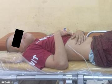 An innocent civilian injured in an attack by so-called PDF terrorists   in Dawei Township of Tanintharyi Region.