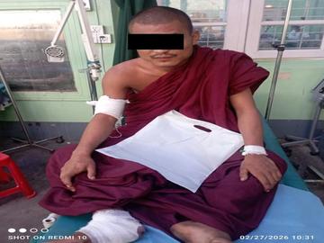 စစ်ကိုင်းတိုင်းဒေသကြီး၊ မြောင်မြို့နယ်၌ PDF အမည်ခံ အကြမ်းဖက်သမာများက Drone ဖြင့် Drop Bomb များ ပစ်ချတိုက်ခိုက်ခဲ့မှုကြောင့် သံဃာတော် တစ်ပါး  ထိခိုက်ဒဏ်ရာရရှိမှု မှတ်တမ်းဓာတ်ပုံ။