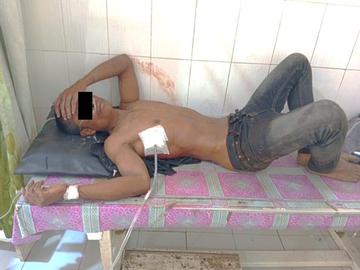 An innocent civilian injured in an attack by a combined group of KNU and so-called PDF terrorists in Phyu Township of Bago Region.