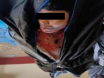 An innocent civilian killed in a reckless shooting by so-called PDF terrorists in Thayetchaung Township of Tanintharyi Region.