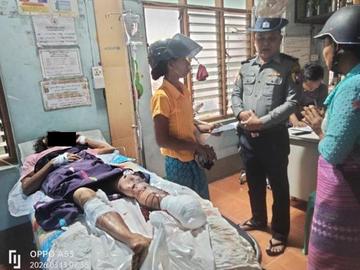 An innocent civilian injured in an improvised explosive device explosion in Madaya Township of Mandalay Region.