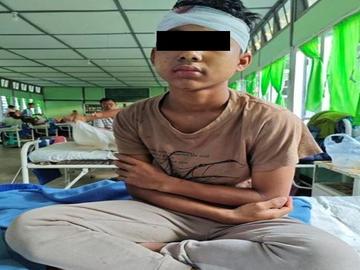 An innocent civilian injured in a heavy weapon attack by so-called PDF terrorists in Myeik Township of Tanintharyi Region.