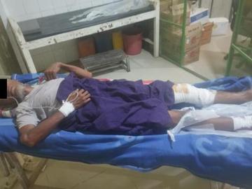 An innocent civilian injured in an improvised explosive device explosion in Salin Township of Magway Region.