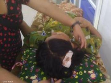 ကရင်ပြည်နယ်၊ သံတောင်ကြီးမြို့နယ်၌ KNU အကြမ်းဖက်အဖွဲ့နှင့် PDF အမည်ခံ အကြမ်းဖက်သမားများ ပူးပေါင်းအဖွဲ့က လက်နက်ကြီးဖြင့် ပစ်ခတ်တိုက်ခိုက်ခဲ့မှုကြောင့် အပြစ်မဲ့ အရပ်သားပြည်သူ တစ်ဦး ထိခိုက်ဒဏ်ရာရရှိမှု မှတ်တမ်းဓာတ်ပုံ။