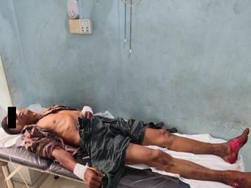 မကွေးတိုင်းဒေသကြီး၊ ချောက်မြို့နယ်၌ PDF အမည်ခံ အကြမ်းဖက်သမားများ ထောင်ထားသည့်  နင်းမိုင်း တစ်လုံးအား နင်းမိပေါက်ကွဲခဲ့မှုကြောင့် အပြစ်မဲ့ အရပ်သားပြည်သူ တစ်ဦး  ထိခိုက်ဒဏ်ရာရရှိမှု မှတ်တမ်းဓာတ်ပုံ။