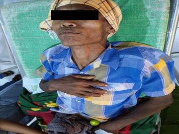 မန္တလေးတိုင်းဒေသကြီး၊ ညောင်ဦးမြို့နယ်၌ PDF အမည်ခံ အကြမ်းဖက်သမားများက လက်နက်ကြီးဖြင့် ပစ်ခတ်ခဲ့မှုကြောင့် အမျိုးသား တစ်ဦး  ထိခိုက်ဒဏ်ရာရရှိမှု မှတ်တမ်းဓာတ်ပုံ။