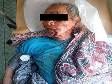 မကွေးတိုင်းဒေသကြီး၊ စလင်းမြို့နယ်၌ PDF အမည်ခံ အကြမ်းဖက်သမားများ ထောင်ထားသည့်  နင်းမိုင်း တစ်လုံးအား နင်းမိပေါက်ကွဲခဲ့မှုကြောင့် အပြစ်မဲ့ အရပ်သားပြည်သူ  တစ်ဦး သေဆုံးမှု မှတ်တမ်းဓာတ်ပုံ။