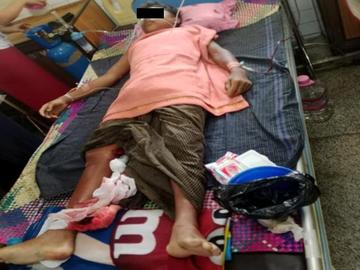 An innocent civilian injured in an improvised explosive device explosion in Dawei Township of Tanintharyi Region.