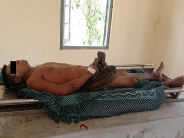 An innocent civilian killed in an improvised explosive device explosion in Salin Township of Magway Region.