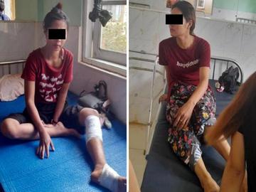 Two innocent civilians injured in an improvised explosive device explosion in Shwegyin Township of Bago Region.