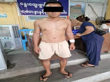 စစ်ကိုင်းတိုင်းဒေသကြီး၊ ပုလဲမြို့နယ်၌ PDF အမည်ခံ အကြမ်းဖက်သမားများက လက်နက်ကြီးဖြင့် ပစ်ခတ်ခဲ့မှုကြောင့် အပြစ်မဲ့ အရပ်သားပြည်သူ တစ်ဦး ထိခိုက်ဒဏ်ရာရရှိမှု မှတ်တမ်းဓာတ်ပုံ။