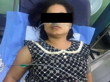 An innocent civilian injured in a heavy weapon attack by so-called PDF terrorists in Myinmu Township of Sagaing Region.  
