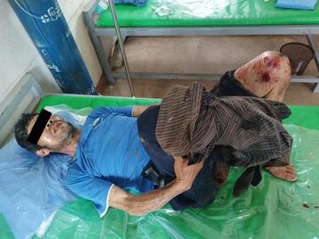 An innocent civilian injured in an improvised explosive device planted by the TNLA terrorist group in Naungcho Township of Shan State.